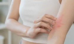 Минздрав России рассказал о способах сохранить здоровье кожи при диабете minzdrav rossii rasskazal o sposobah sohranit zdorove kozhi pri diabete-fabrec-ru-0