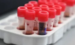 Тюмень укрепляет регистр доноров костного мозга с поддержкой Санкт-Петербурга tyumen ukreplyaet registr donorov kostnogo mozga s podderzhkoj sanktpeterburga-fabrec-ru-0