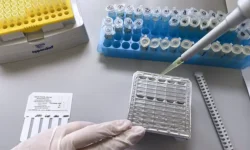 rospotrebnadzor kontroliruet ospu obezyan v mytishhah podmoskovya-fabrec-ru-0