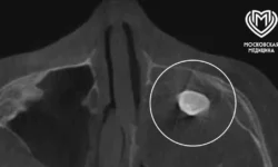 Успехи медицины Московской области – Филатовская больница и МОЦОМД uspehi medicziny moskovskoj oblasti filatovskaya bolnicza i moczomd-fabrec-ru-0