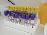 Исследование РНФ выявило недостаток липидов при шизофрении для новой диагностики issledovanie rnf vyyavilo nedostatok lipidov pri shizofrenii dlya novoj diagnostiki-lavi-su-174359952400-0