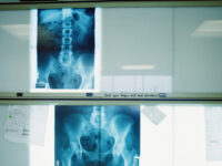 Советы травматолога Дениса Наумова как встретить новогодние праздники без травм и с улыбкой sovety travmatologa denisa naumova kak vstretit novogodnie prazdniki bez travm i s ulybkoj-lavi-su-173612903500-0