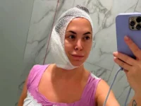 natalya friske delitsya istoriej spaseniya posle ekstrennoj operaczii-lavi-su-0