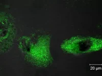 proryv rhtu imeni di mendeleeva i instituta biologii gena ran v diagnostike kalcziya-lavi-su-0