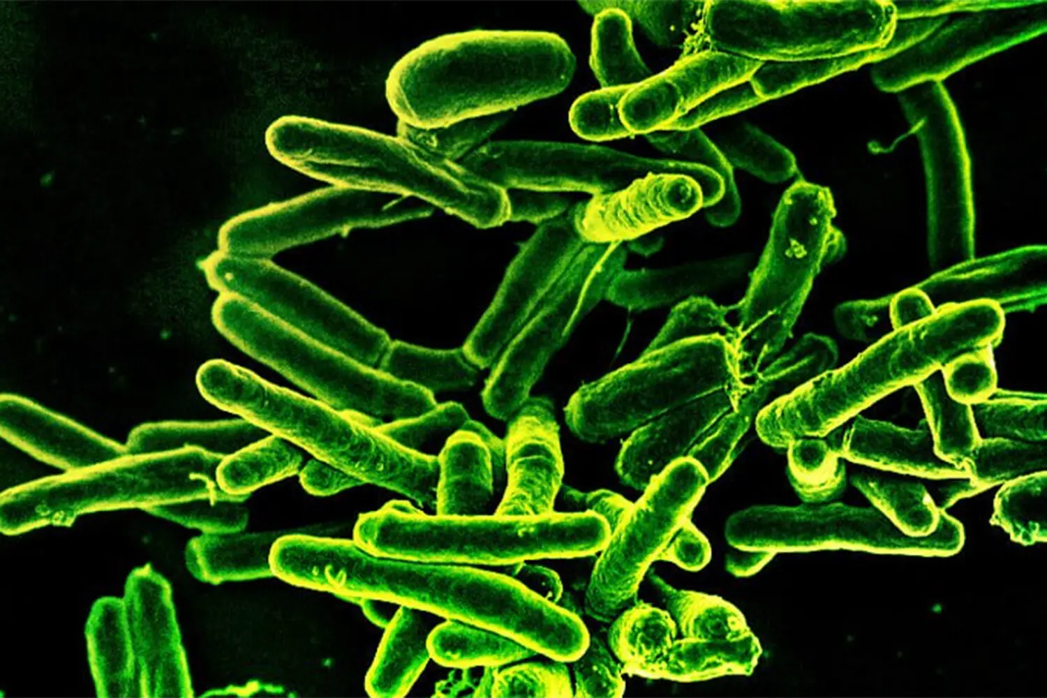 Уникальные механизмы Mycobacterium tuberculosis раскрыты Институтом микробиологии КАН-0