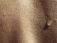 gialuronovaya kislota zashhishhaet kozhu v otopitelnyj sezon i darit siyanie-lavi-su-0