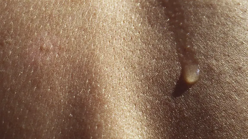 Дерматолог предупредила о рисках для кожи в отопительный сезон