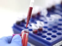 РНФ открыл новые онкомаркеры щитовидной железы по методике ИМБ РАН rnf otkryl novye onkomarkery shhitovidnoj zhelezy po metodike imb ran-lavi-su-0