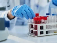 marina gureeva rasskazala o riskah kandidoza pri immunodeficzite i v reanimaczii-lavi-su-0