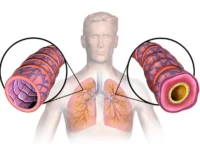 Ученые СГМУ предлагают новые подходы к контролю астмы uchenye sgmu predlagayut novye podhody k kontrolyu astmy-lavi-su-0