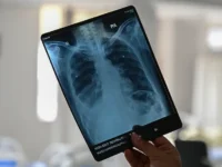 Игорь Долгополов рассказал, как ранняя диагностика повышает шансы igor dolgopolov rasskazal kak rannyaya diagnostika povyshaet shansy-lavi-su-0