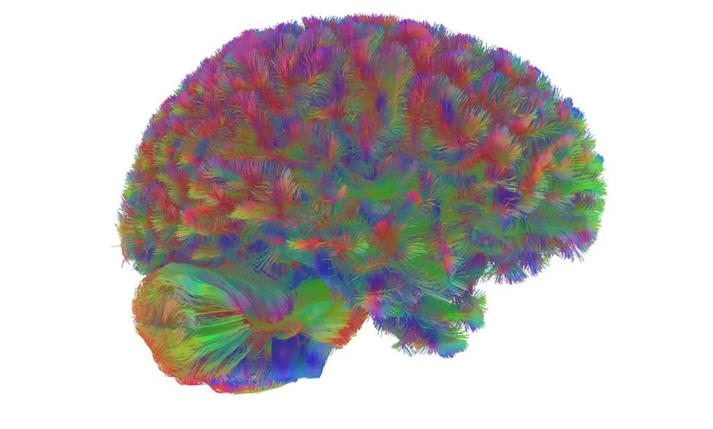 Мозг созревает после 30 лет выяснили в Кембриджском университете-0