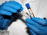 rezyume issledovaniya hantavirus andes genom stabilen v rudn-lavi-su-0