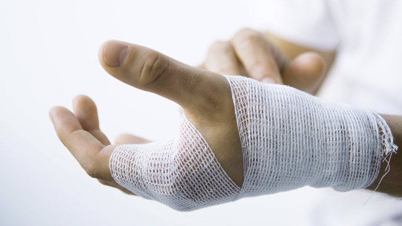 РИА Новости: украинца с 75% ожогом тела мобилизовали и отправили в лагерь НАТО