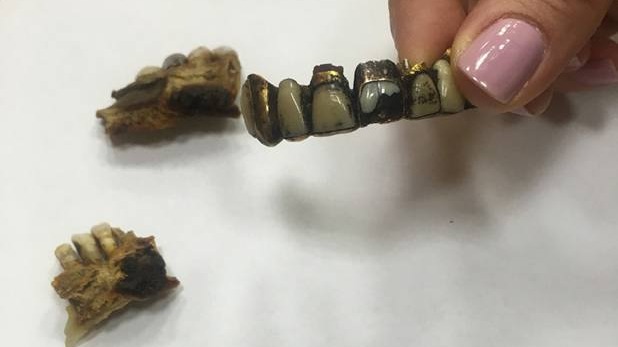 Челюсть Адольфа Гитлера