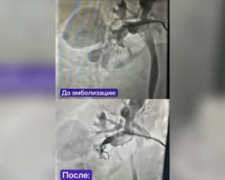 Счастливое спасение матери и ребёнка в РКБ Казани из Рыбно-Слободского района schastlivoe spasenie materi i rebyonka v rkb kazani iz rybnoslobodskogo rajona-signaldaily-ru-0