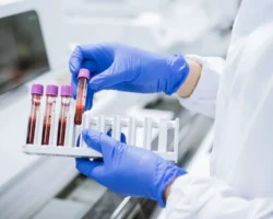 Исследовательский центр питания человека HNRCA представил новые маркеры старения issledovatelskij czentr pitaniya cheloveka  predstavil novye markery stareniya-signaldaily-ru-0