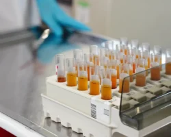 Роспотребнадзор разработал первый экспресс-тест на гепатит С с результатом за полчаса rospotrebnadzor razrabotal pervyj ekspresstest na gepatit s s rezultatom za polchasa-signaldaily-ru-0