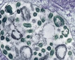 В Эфиопии подтверждена вспышка вируса Марбург, введены меры ВОЗ и Роспотребнадзора v efiopii podtverzhdena vspyshka virusa marburg vvedeny mery voz i rospotrebnadzora-signaldaily-ru-0