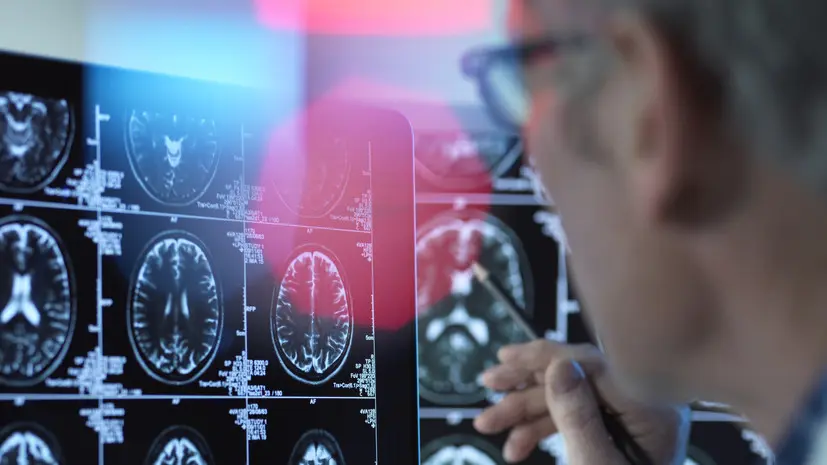 Академик Рогаев рассказал о причинах отсутствия лекарства от болезни Альцгеймера