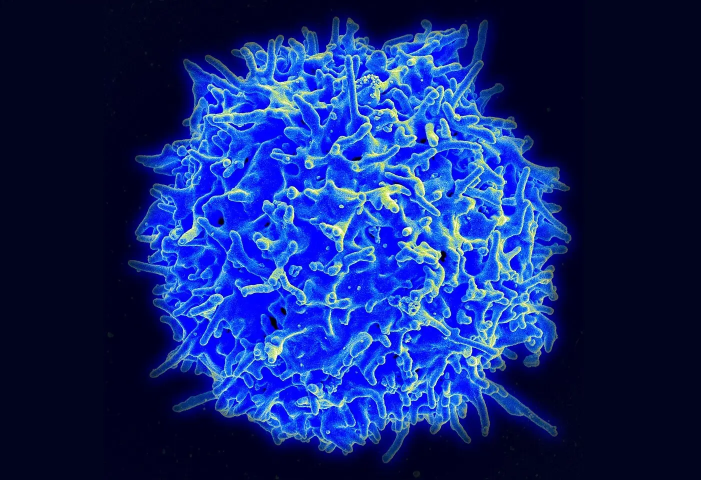 CD4+T-клетки и ЦММ открывают новые горизонты прогнозирования старения-0