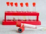 Как грызуны способствуют распространению хантавируса и меры защиты kak gryzuny sposobstvuyut rasprostraneniyu hantavirusa i mery zashhity-mynewton-ru-0