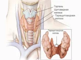 Валерий Литвинов из Пермского Политеха о щитовидной железе и роли йода valerij litvinov iz permskogo politeha o shhitovidnoj zheleze i roli joda-mynewton-ru-0