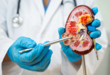 Новое исследование раскрывает влияние стойких химических соединений на здоровье почек 78125f18-d307-41b9-b0ce-a82e46e0ad36-6783f79f