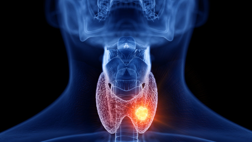 Эндокринолог Теплова назвала проявления заболевания щитовидной железы