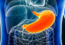 Острая пища и её влияние на здоровье желудка ostraya pishha i eyo vliyanie na zdorove zheludka-onlymainnews-ru-174126562200-0