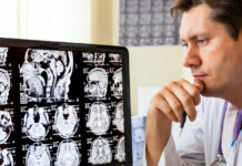 Прорыв в терапии глиобластомы через белок ZNF638 и иммуноонкологические препараты центра Сильвестра Doctor looking at ct scan