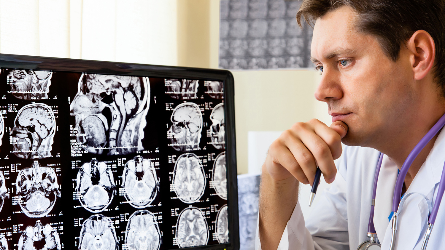 Прорыв в терапии глиобластомы через белок ZNF638 и иммуноонкологические препараты центра Сильвестра-0