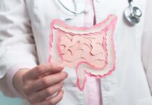 Как стресс воздействует на кишечник раскрыла терапевт Наталья Леонтьева DoctorHoldingDecorativeModelIntestineGastroenterologyHealthyDigestionMicrobiomeIntestine