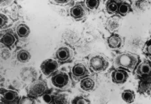 Исследователи из CRG нашли метод блокировки вируса герпеса HSV-1 issledovateli iz nashli metod blokirovki virusa gerpesa 1-onlymainnews-ru-0