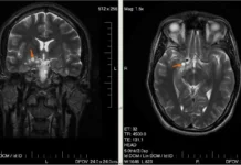 YOLO v11 и команда Сеченовского Университета создали ИИ для диагностики опухолей 11 i komanda sechenovskogo universiteta sozdali ii dlya diagnostiki opuholej-onlymainnews-ru-0