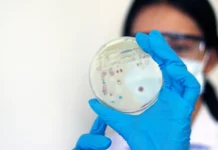 Роспотребнадзор усиливает контроль за легионеллезом во Франции rospotrebnadzor usilivaet kontrol za legionellezom vo franczii-onlymainnews-ru-0