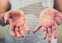 Профессор Альтштейн делится оптимистичным взглядом на вакцинацию от ветрянки professor altshtejn delitsya optimistichnym vzglyadom na vakczinacziyu ot vetryanki-onlymainnews-ru-0