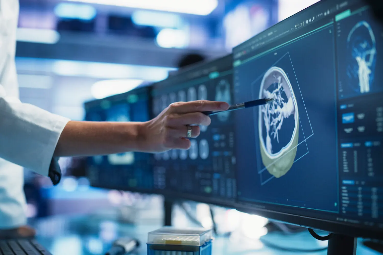 Университет Сан-Паулу разрабатывает квантовые нейросети для диагностики рака груди по маммографиям-0