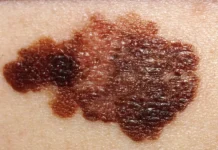 Центр имени Гамалеи и Михаил Мурашко делятся перспективами Неоонковак czentr imeni gamalei i mihail murashko delyatsya perspektivami neoonkovak-onlymainnews-ru-0