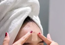 В Котласе госпитализация после случая с прыщом v kotlase gospitalizacziya posle sluchaya s pryshhom-onlymainnews-ru-0