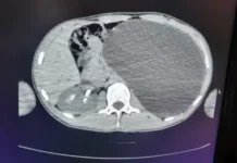 Новосибирские врачи из ДГКБ № 1 провели уникальную операцию подростку novosibirskie vrachi iz dgkb 1 proveli unikalnuyu operacziyu podrostku-onlymainnews-ru-0