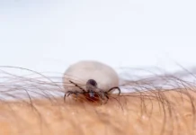 kak olga malinovskaya i vladislav zhemchugov sovetuyut borotsya s kleshhami-onlymainnews-ru-0