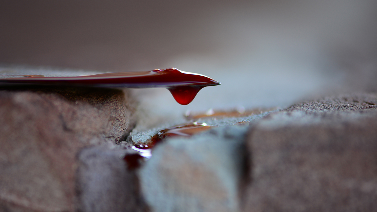 Девушка узнала о помолвке возлюбленного с соперницей и отрезала ему гениталии