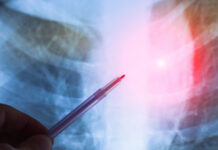 Инновационное лечение онкопациентов с метастазами в костях представила известный специалист 24e1e3dc-04d4-46ba-8f37-0e5262cdb3a5-67f53838