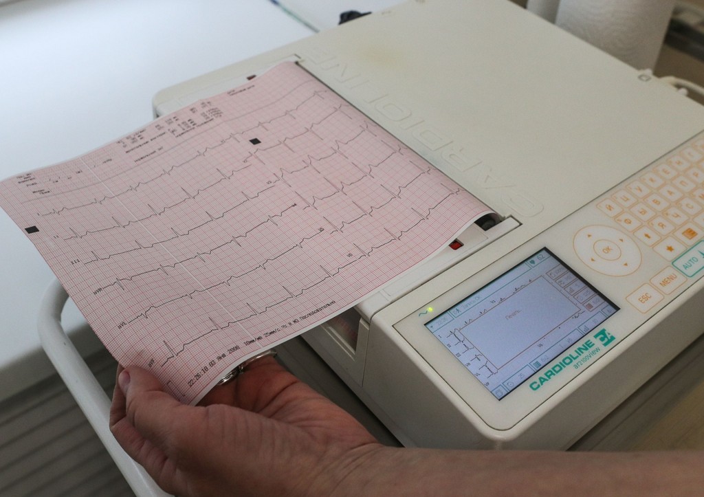Раскрыты новые подробности о состоянии олимпийской чемпионки Сметаниной