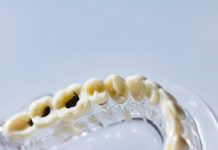 kak karies svyazan so zdorovem serdcza i sustavov-todey-ru-174061505700-0