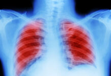 Ольга Уланкина и EVALI Как сохранить здоровье легких при использовании вейпов olga ulankina i kak sohranit zdorove legkih pri ispolzovanii vejpov-todey-ru-174238226400-0