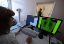 tuberkulez bet rekordy rossiya i voz sporyat o masshtabah epidemii-todey-ru-174285906300-0