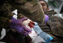 Герой СВО из Узбекистана без руки и ноги столкнулся с отказом России в гражданстве geroj svo iz uzbekistana bez ruki i nogi stolknulsya s otkazom rossii v grazhdanstve-todey-ru-174427859400-0