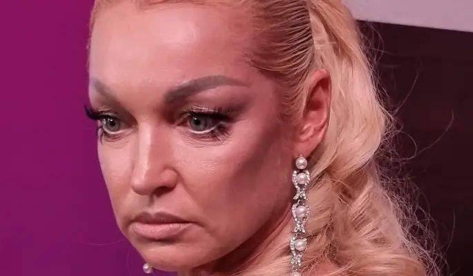 Волочкова избавилась от мешающего ей "уродства" на лице